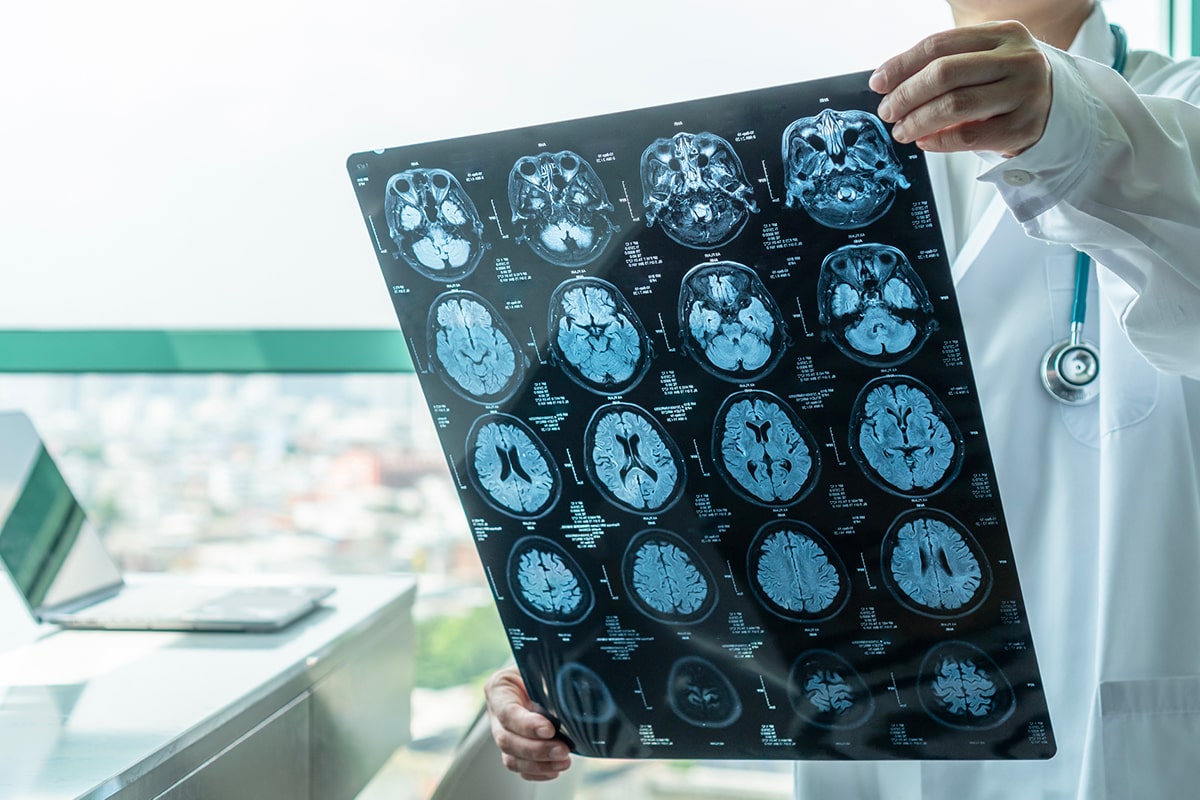 Medico centro diagnostico ostiense che controlla lastra neurologica