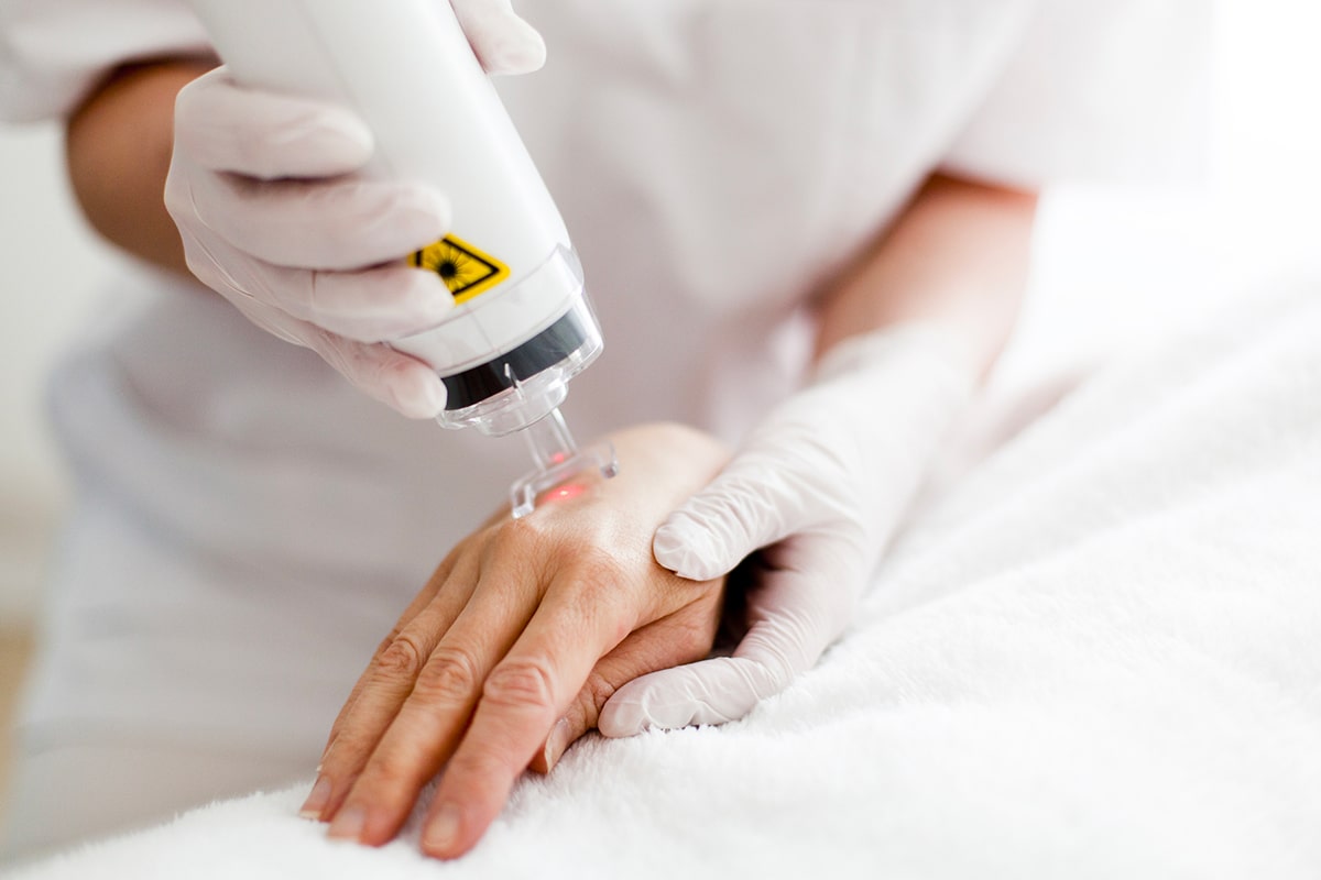 Laserterapia alla mano - centro diagnostico ostiense