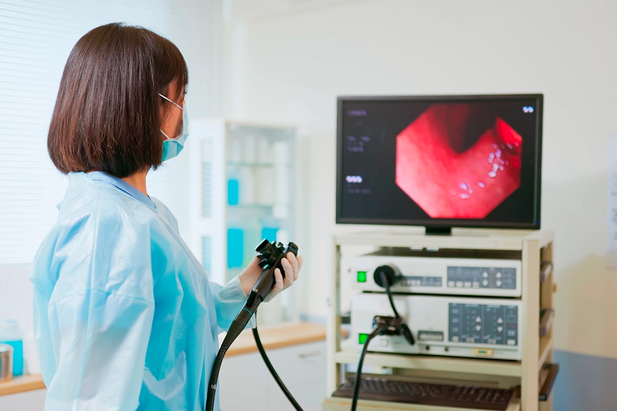 Colonna endoscopica